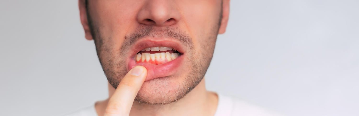 Gum Disease Treatment and Periodontal Health in Berkeley, CA at Acorn Family Dental Care