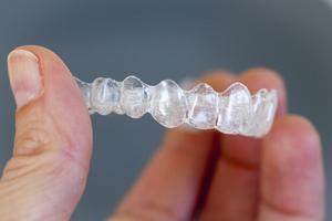 Hand holding Invisalign® Clear Aligners